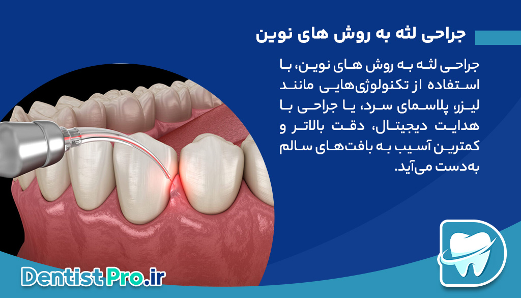 جراحی لثه به روش های نوین؛ تحول در سلامت و زیبایی دهان 27 جراحی لثه به روش های نوین؛ تحول در سلامت و زیبایی دهان