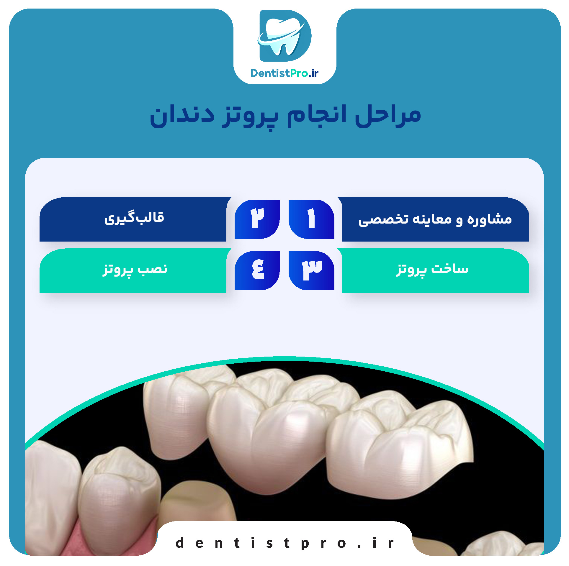 پروتز دندان برای لبخند طبیعی؛ بازسازی لبخند، بازسازی زندگی 29 پروتز دندان برای لبخند طبیعی؛ بازسازی لبخند، بازسازی زندگی