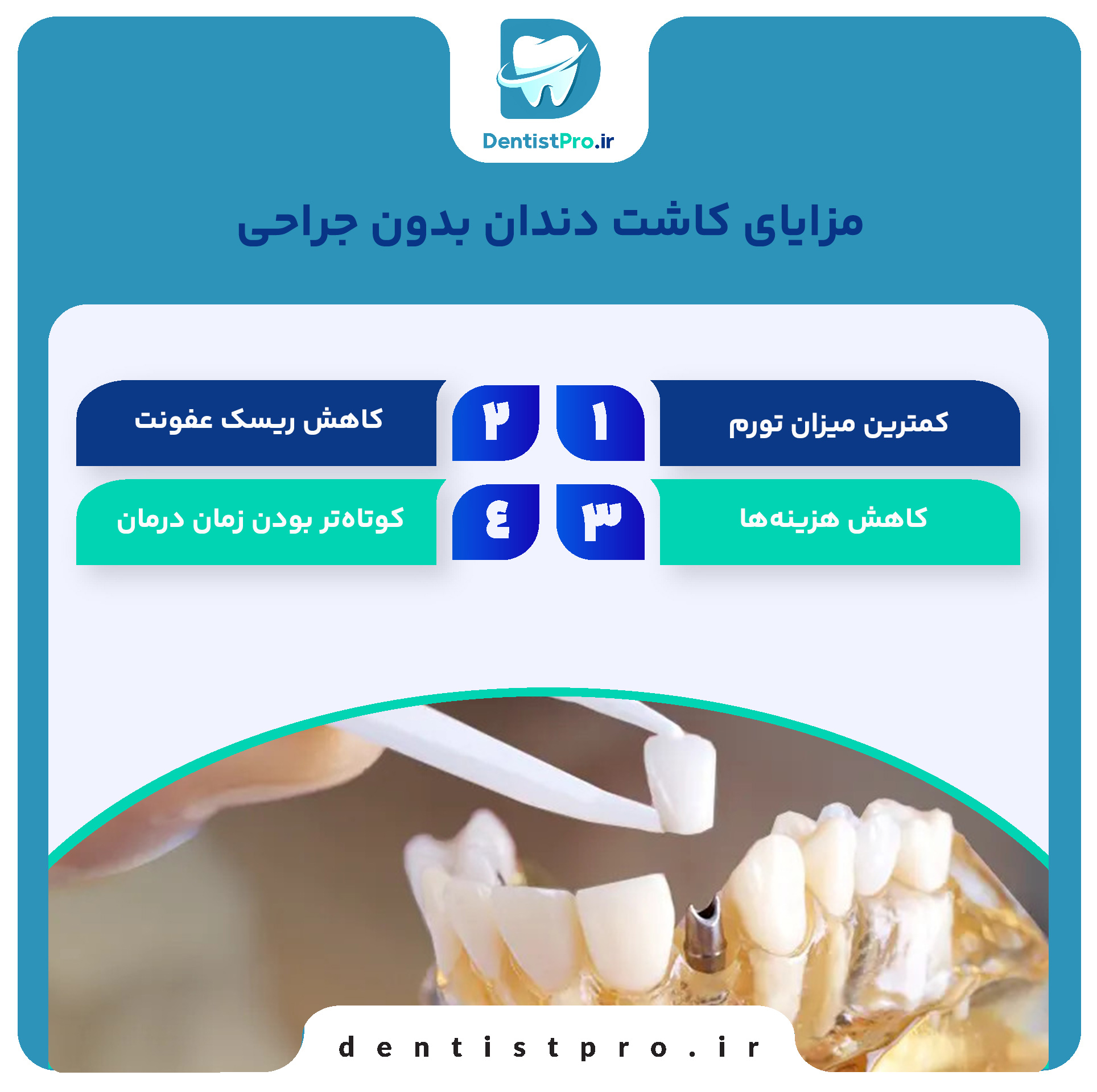 کاشت دندان بدون جراحی: راهی نوین برای بازسازی لبخند 27 کاشت دندان بدون جراحی: راهی نوین برای بازسازی لبخند