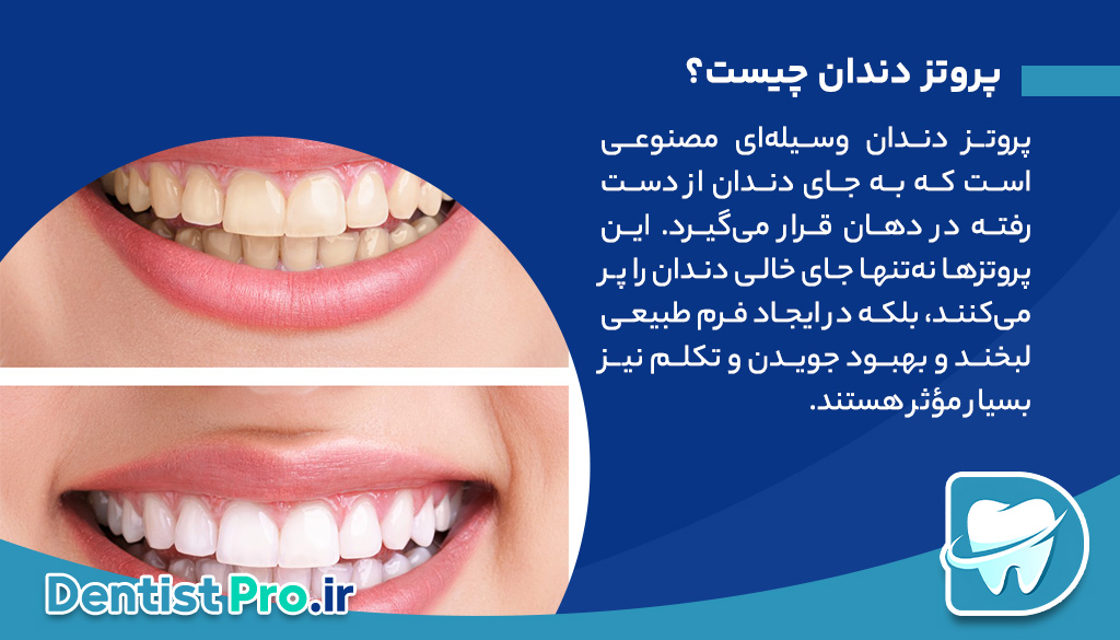پروتز دندان برای لبخند طبیعی؛ بازسازی لبخند، بازسازی زندگی