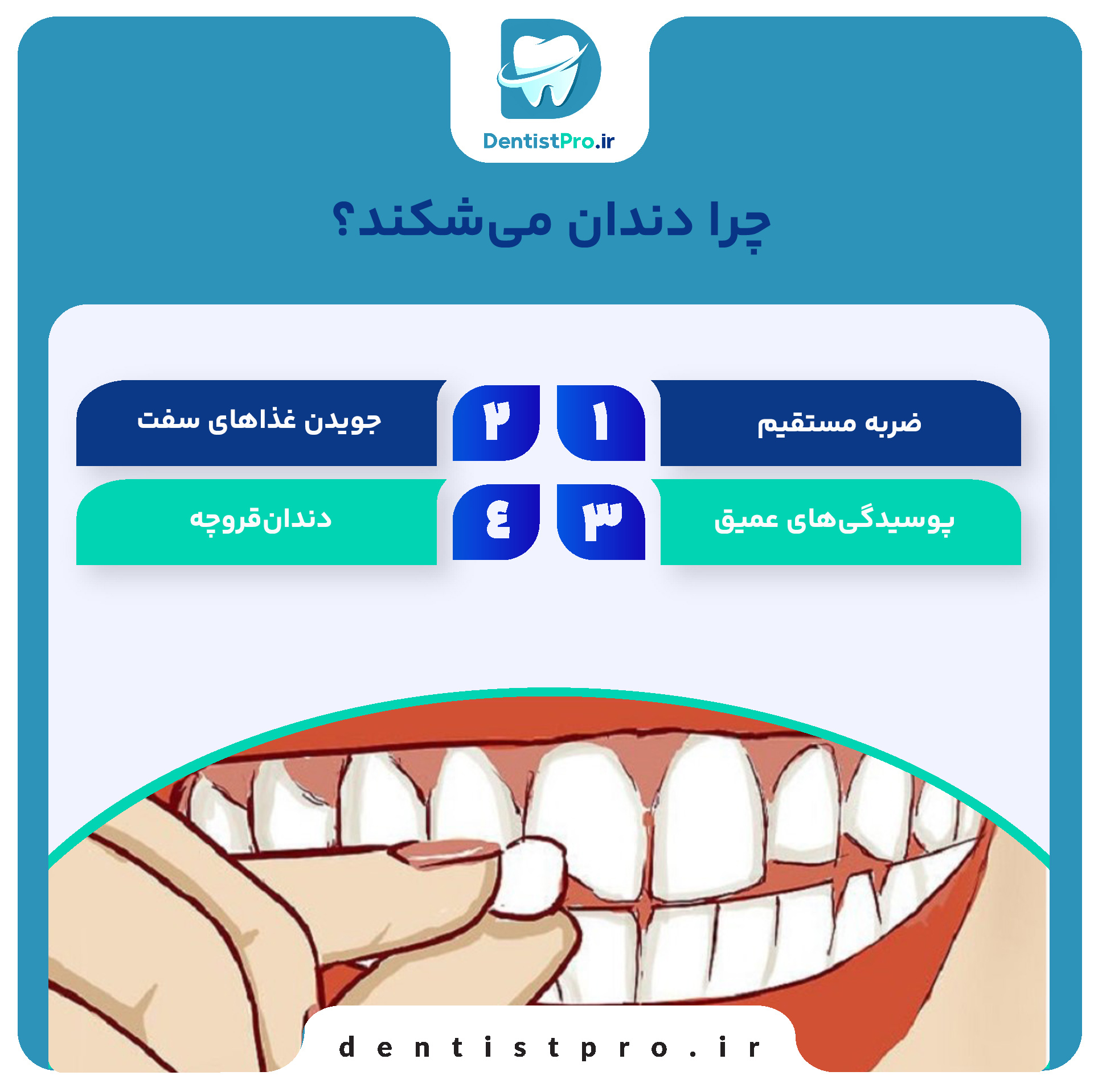 ترمیم دندان های شکسته؛ بازگرداندن لبخند شما با روش‌های نوین