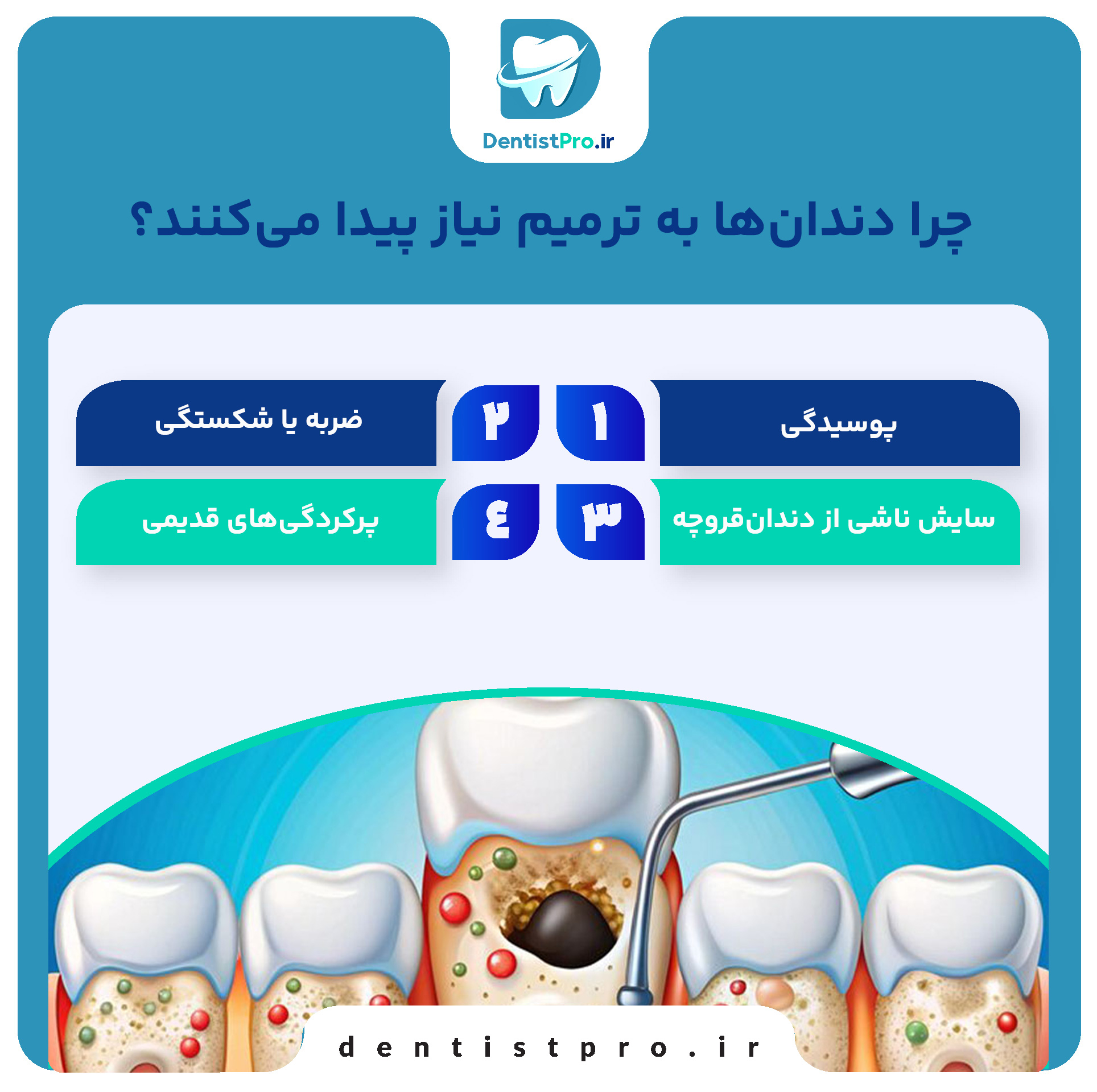 ترمیم دندان ها با مواد درجه یک؛ ترکیبی از دوام، زیبایی و سلامت