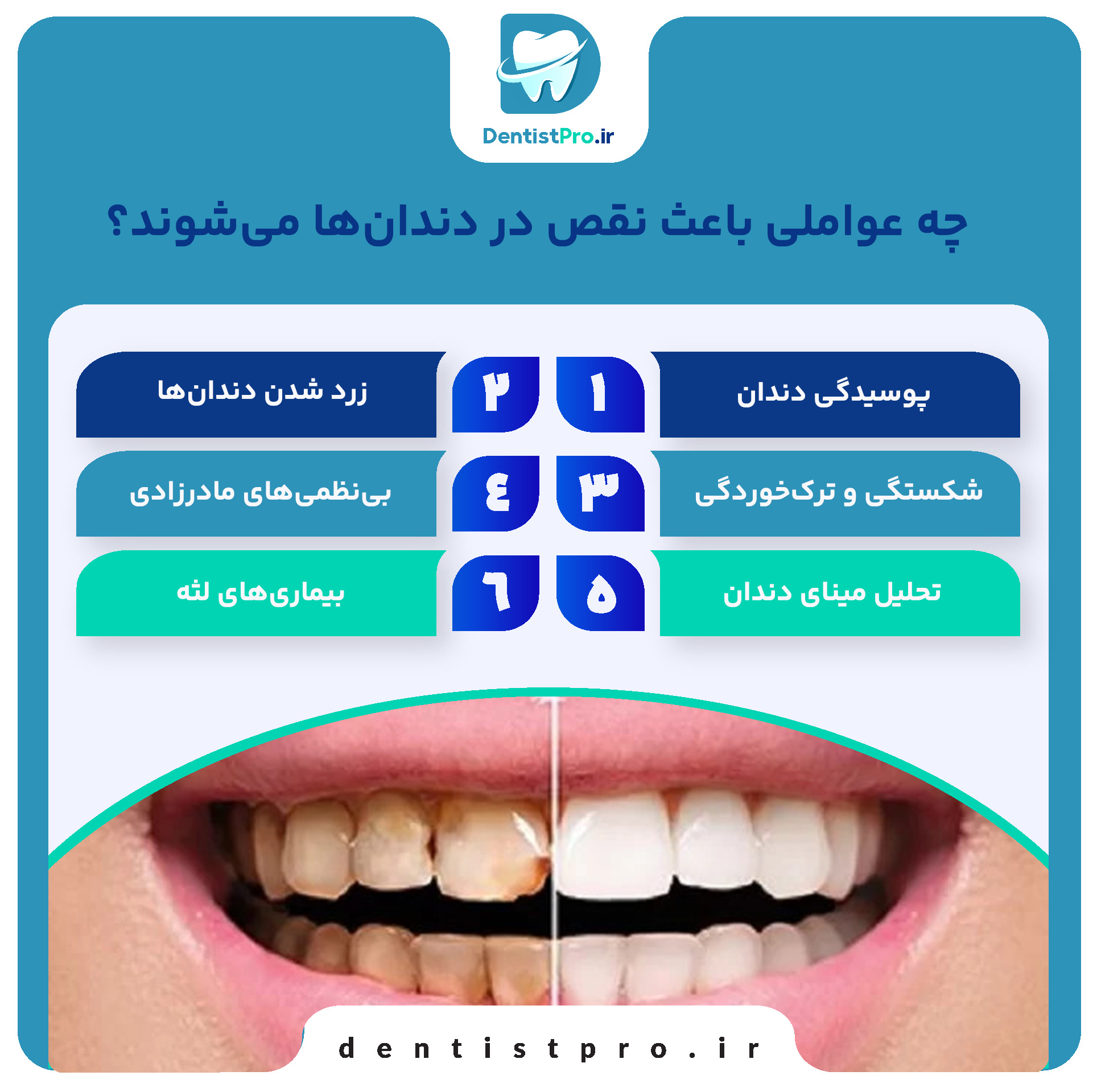 دندان های بدون نقص؛ لبخند کامل، زندگی کامل‌تر