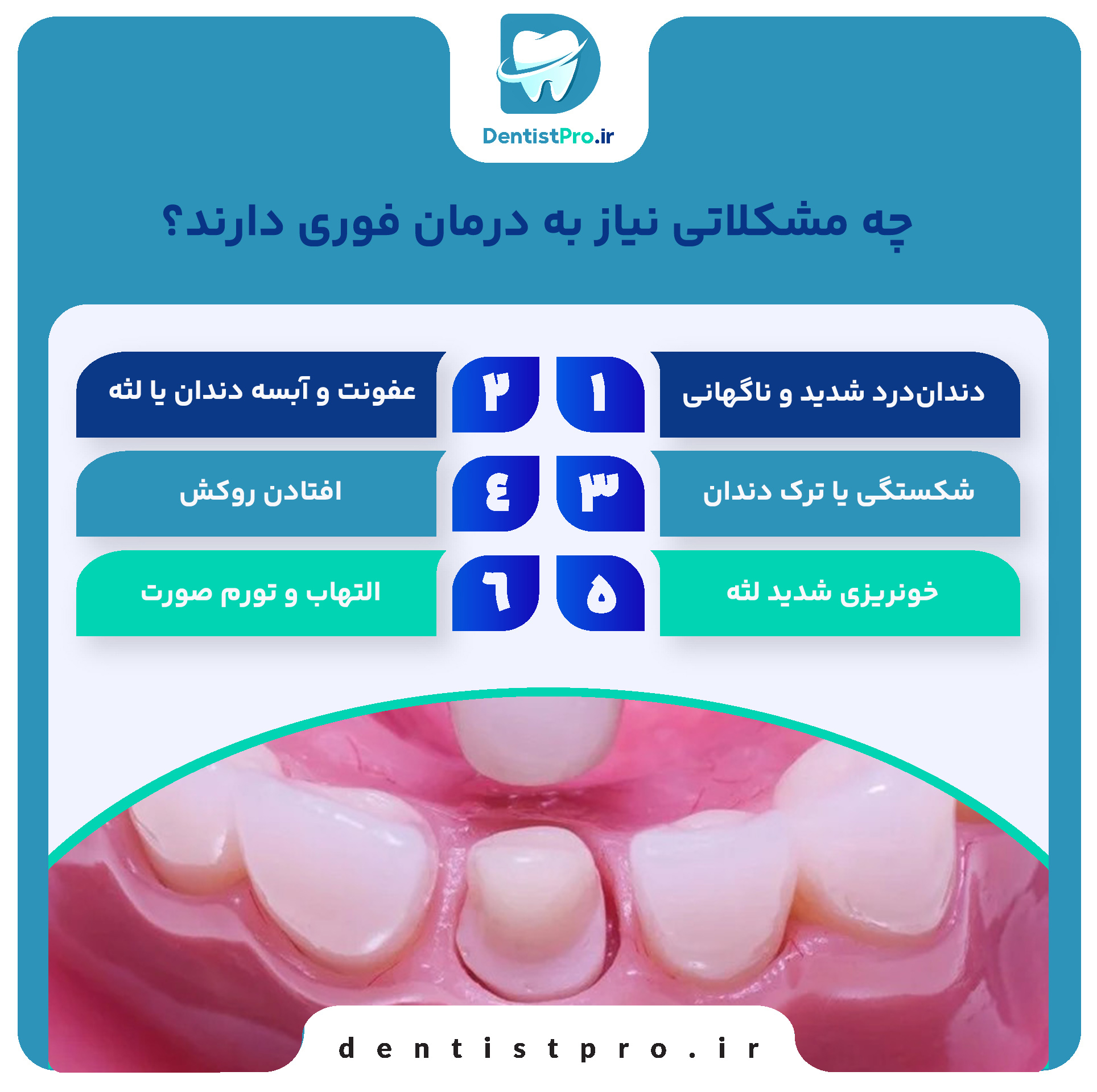 حل مشکلات دندانپزشکی در کمترین زمان؛ نجات لبخند در سریع‌ترین حالت ممکن