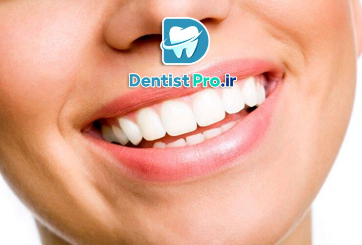 زیباسازی سریع لبخند: راهکارهایی برای تغییر فوری و موثر