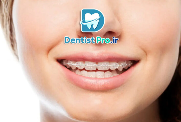 ناهنجاری فک بالا: علل، تشخیص و درمانهای موجود 27 ناهنجاری فک بالا: علل، تشخیص و درمانهای موجود