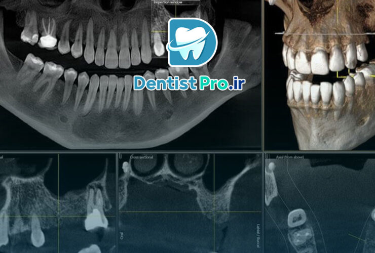 ارتودنسی با تکنولوژی CBCT: تحولی در درمان مشکلات فک و دندان 34 ارتودنسی با تکنولوژی CBCT: تحولی در درمان مشکلات فک و دندان