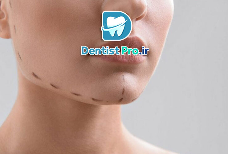 جراحی ارتوگناتیک: اصلاح مشکلات فکی و بهبود عملکرد و زیبایی
