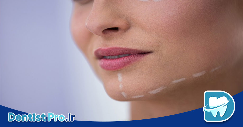 جراحی ارتوگناتیک: اصلاح مشکلات فکی و بهبود عملکرد و زیبایی 28 جراحی ارتوگناتیک: اصلاح مشکلات فکی و بهبود عملکرد و زیبایی