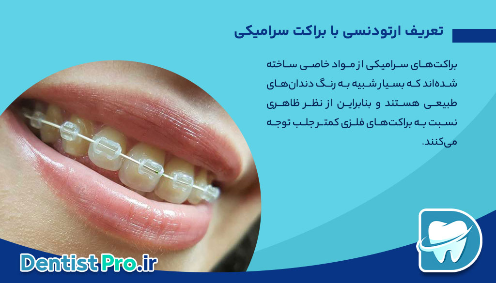 ارتودنسی با براکت سرامیکی 26 ارتودنسی با براکت سرامیکی