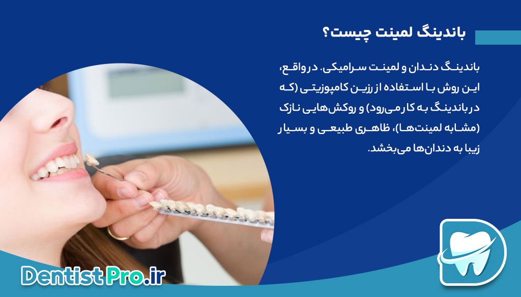 همه چیز درباره باندینگ لمینت: راهکاری نوین در زیبایی دندان 26 همه چیز درباره باندینگ لمینت: راهکاری نوین در زیبایی دندان
