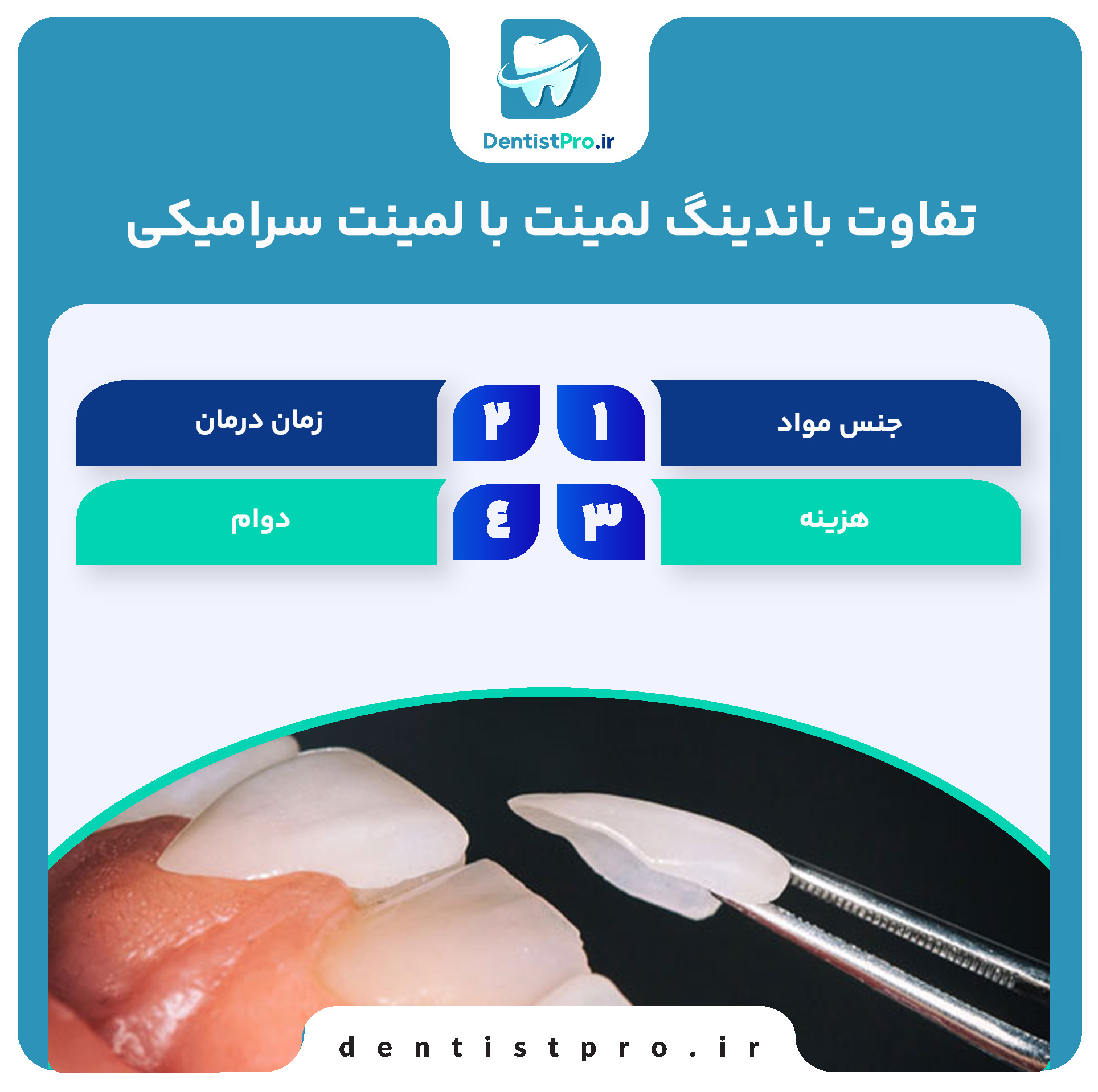 همه چیز درباره باندینگ لمینت: راهکاری نوین در زیبایی دندان 28 همه چیز درباره باندینگ لمینت: راهکاری نوین در زیبایی دندان