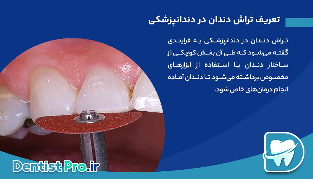 پوسیدگی زودرس دندان شیری: علل، علائم، پیشگیری و درمان