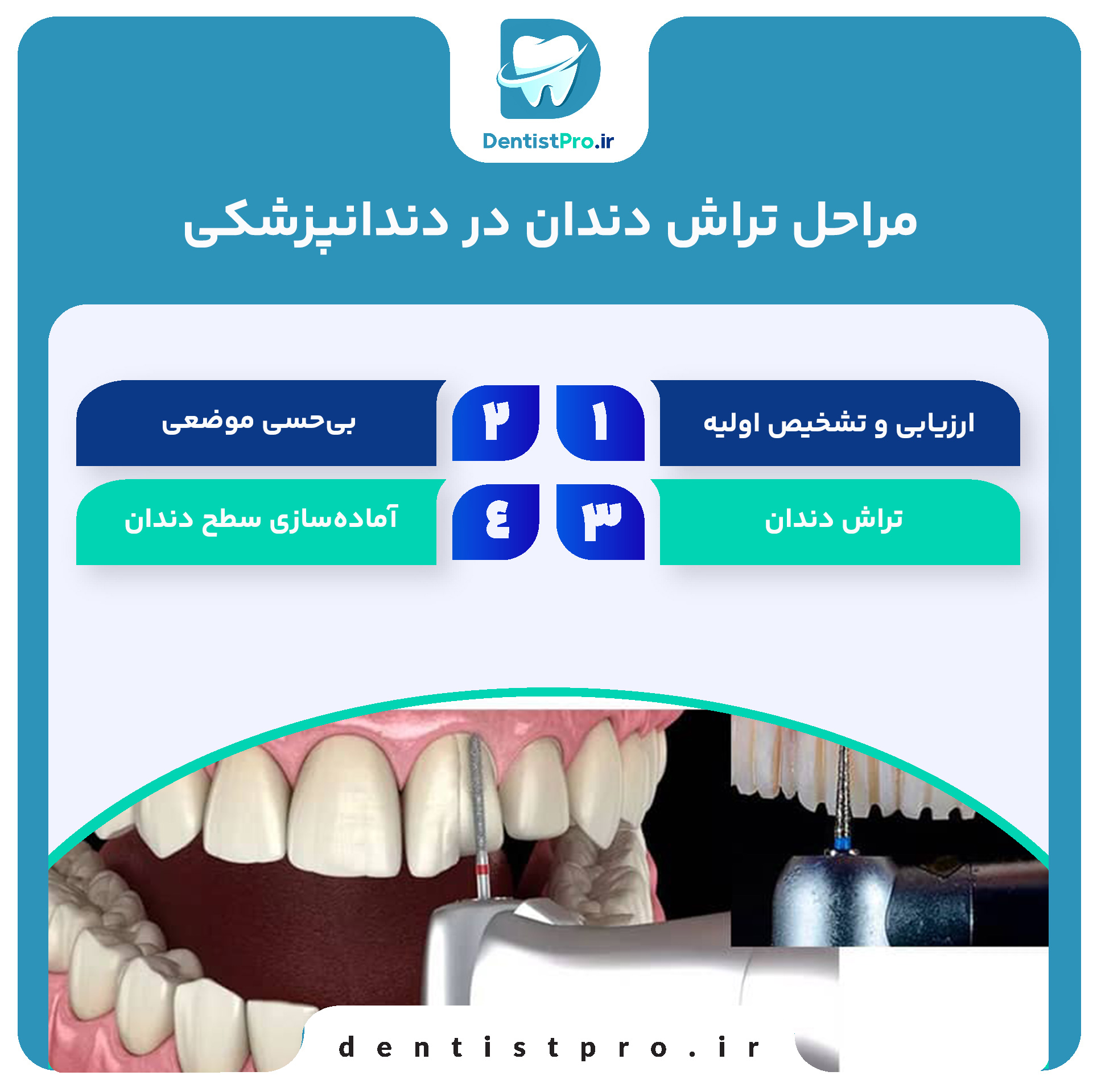 پوسیدگی زودرس دندان شیری: علل، علائم، پیشگیری و درمان