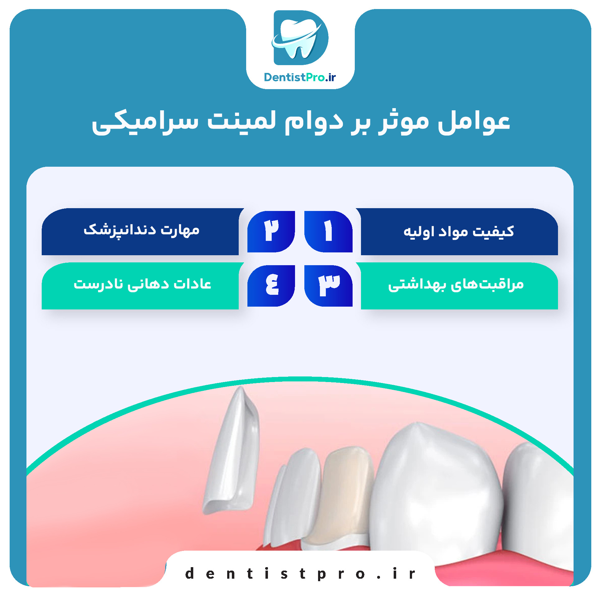 بررسی جامع دوام لمینت سرامیکی: زیبایی ماندگار برای لبخند شما