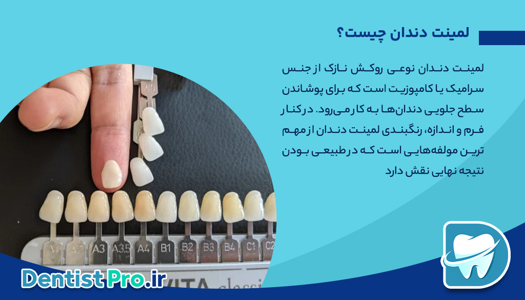 راهنمای کامل رنگبندی لمینت دندان: چگونه لبخندی طبیعیتر داشته باشیم؟ 26 راهنمای کامل رنگبندی لمینت دندان: چگونه لبخندی طبیعیتر داشته باشیم؟