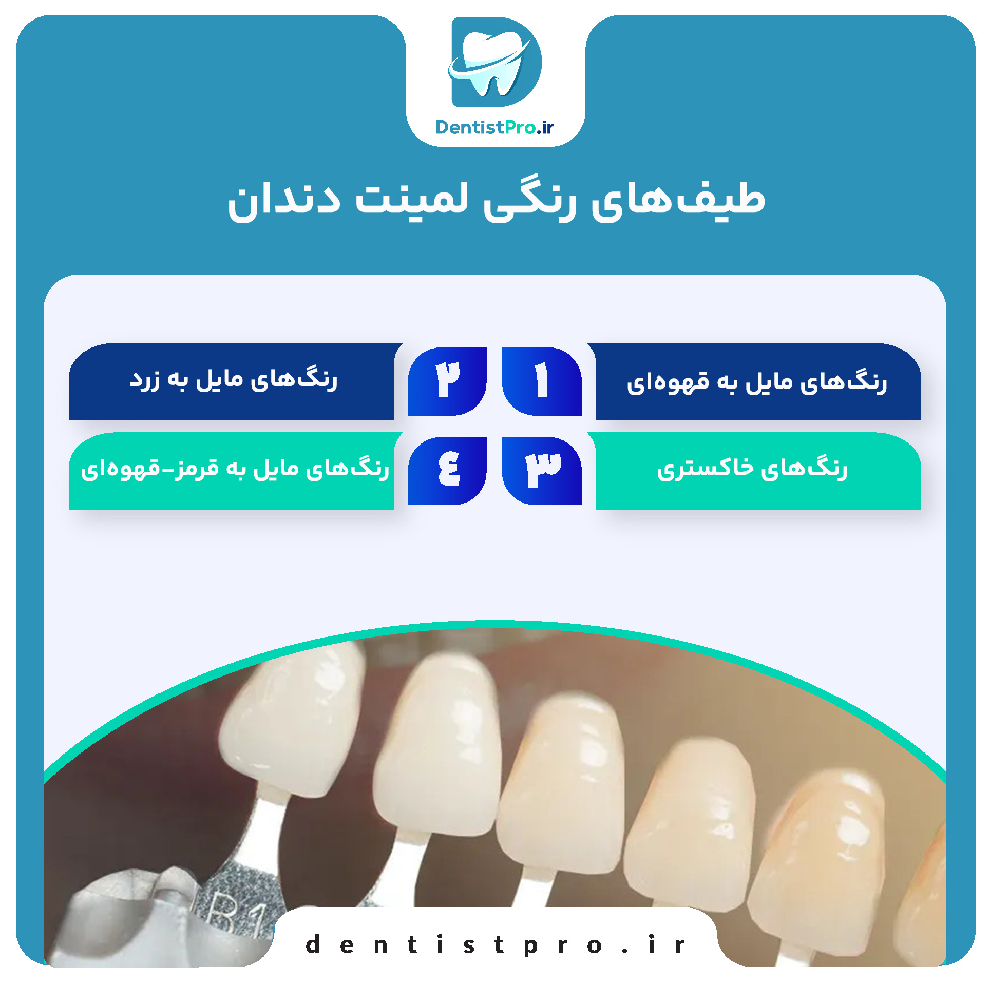 راهنمای کامل رنگبندی لمینت دندان: چگونه لبخندی طبیعیتر داشته باشیم؟ 27 راهنمای کامل رنگبندی لمینت دندان: چگونه لبخندی طبیعیتر داشته باشیم؟
