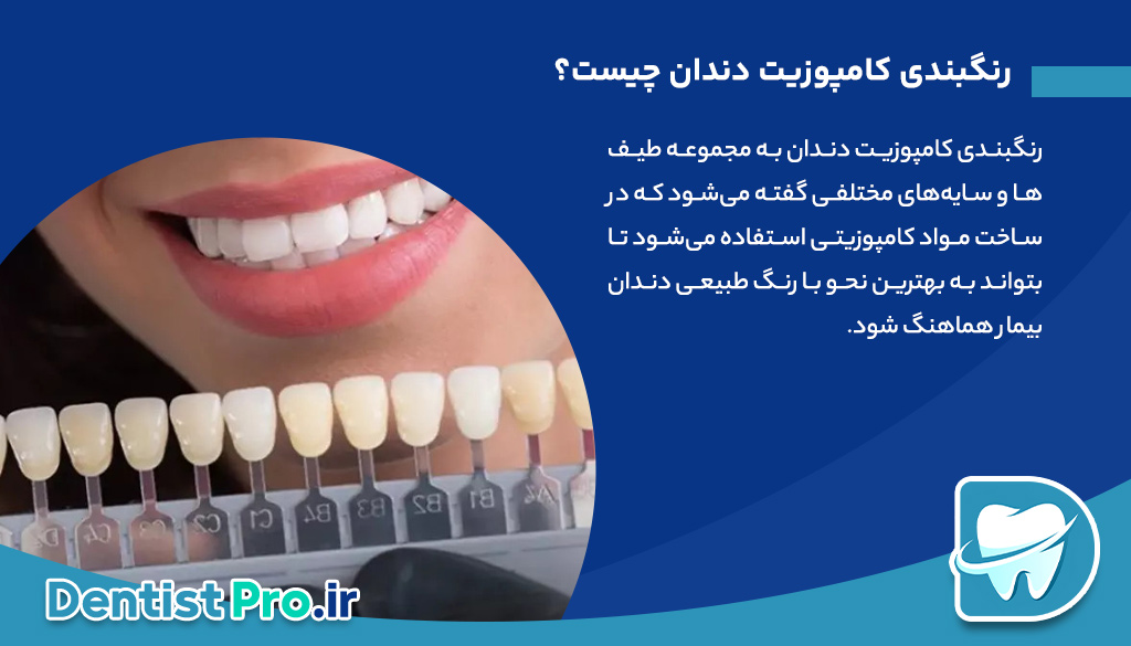 رنگبندی کامپوزیت دندان: راهنمای کامل برای انتخاب رنگ مناسب و تأثیرات آن در زیبایی لبخند