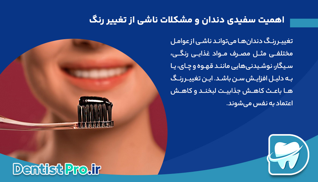 سفیدی دندان بدون بلیچینگ؛ راهکارهایی طبیعی و موثر برای لبخندی درخشان 26 سفیدی دندان بدون بلیچینگ؛ راهکارهایی طبیعی و موثر برای لبخندی درخشان