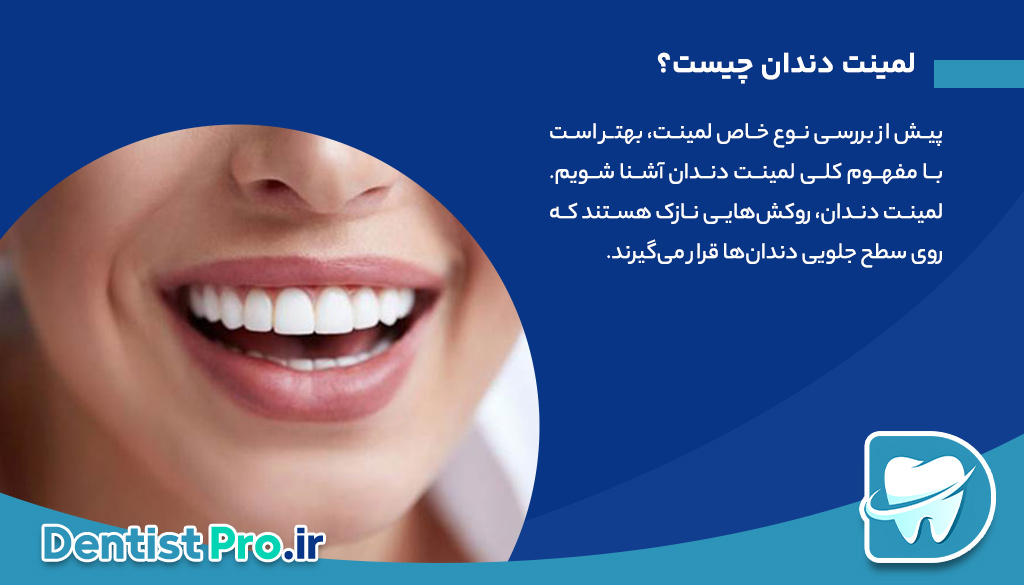 لمینت تمام سرامیک: راهکاری حرفه‌ای برای لبخندی درخشان و طبیعی