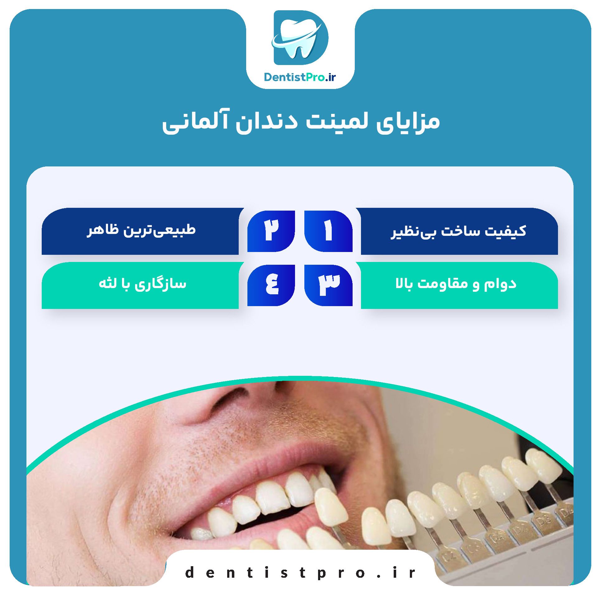 لمینت دندان آلمانی: ترکیبی از تکنولوژی، زیبایی و دوام