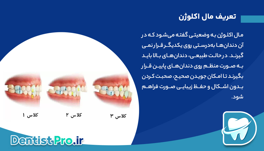 مال اکلوژن: بررسی جامع اختلالات قرارگیری دندانها و راههای درمانی 26 مال اکلوژن: بررسی جامع اختلالات قرارگیری دندانها و راههای درمانی