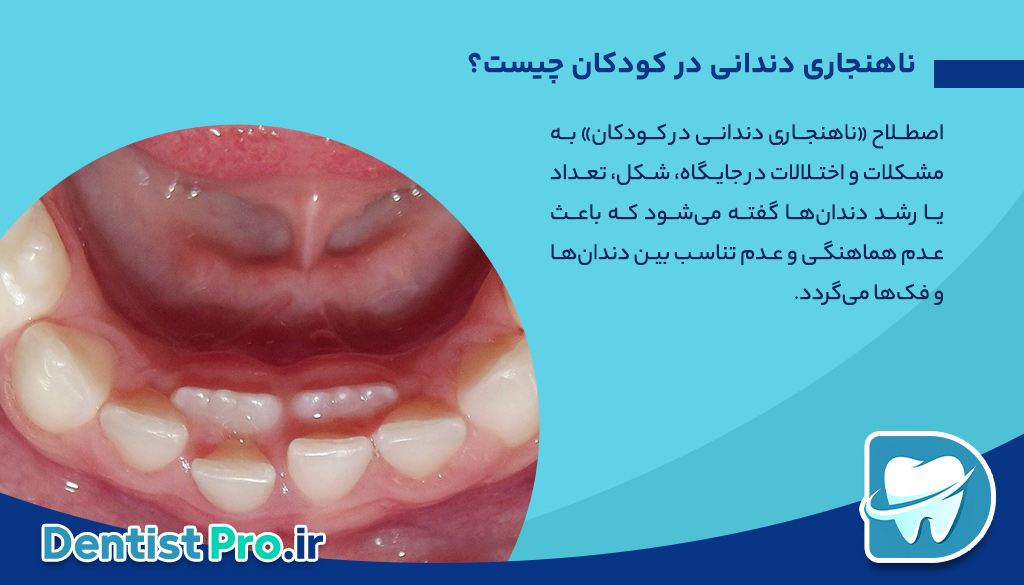 ناهنجاری دندانی در کودکان: علل، انواع، درمان‌ها و راه‌های پیشگیری