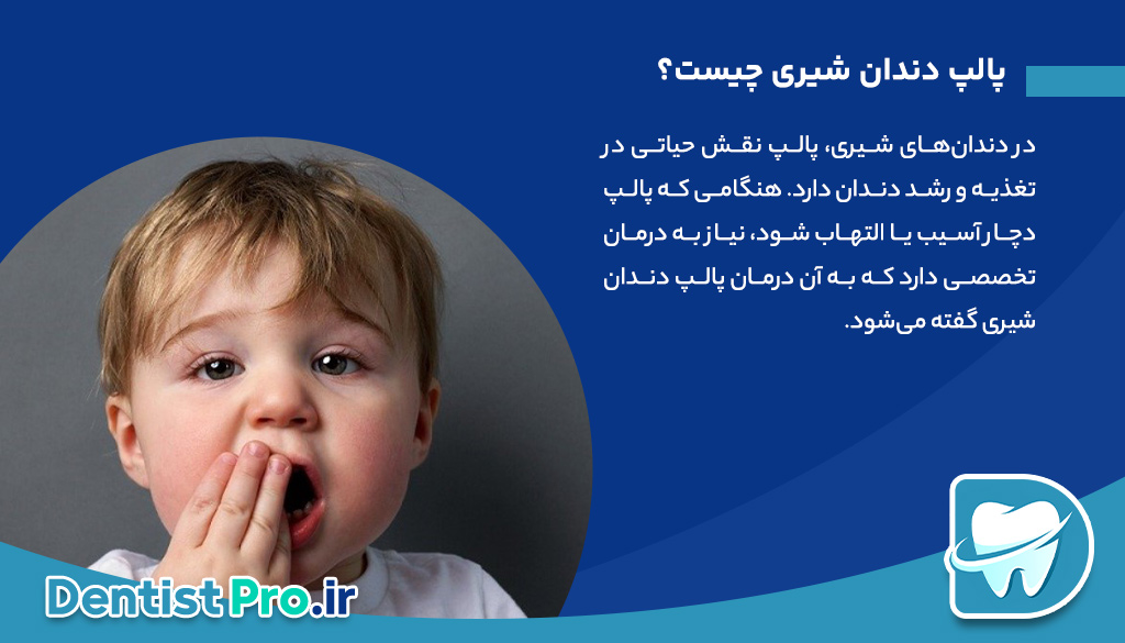 درمان پالپ دندان شیری: راهنمای جامع حفظ سلامت دندان‌های کودکان