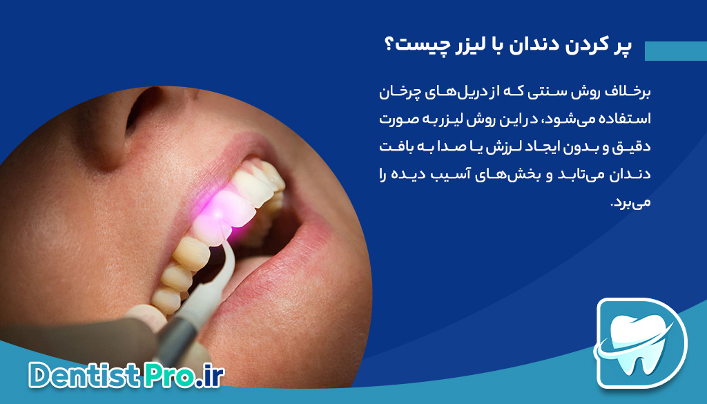 پر کردن دندان با لیزر: تحولی نوین در درمان پوسیدگی دندان