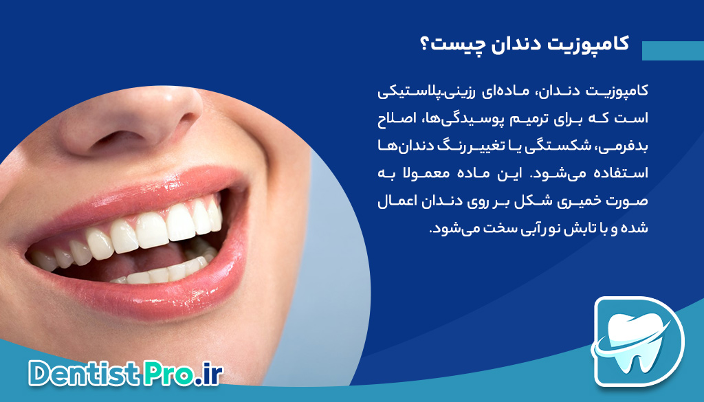 کامپوزیت دندان آنتی استین+راهکاری برای لبخندی ماندگار و بدون تغییر رنگ