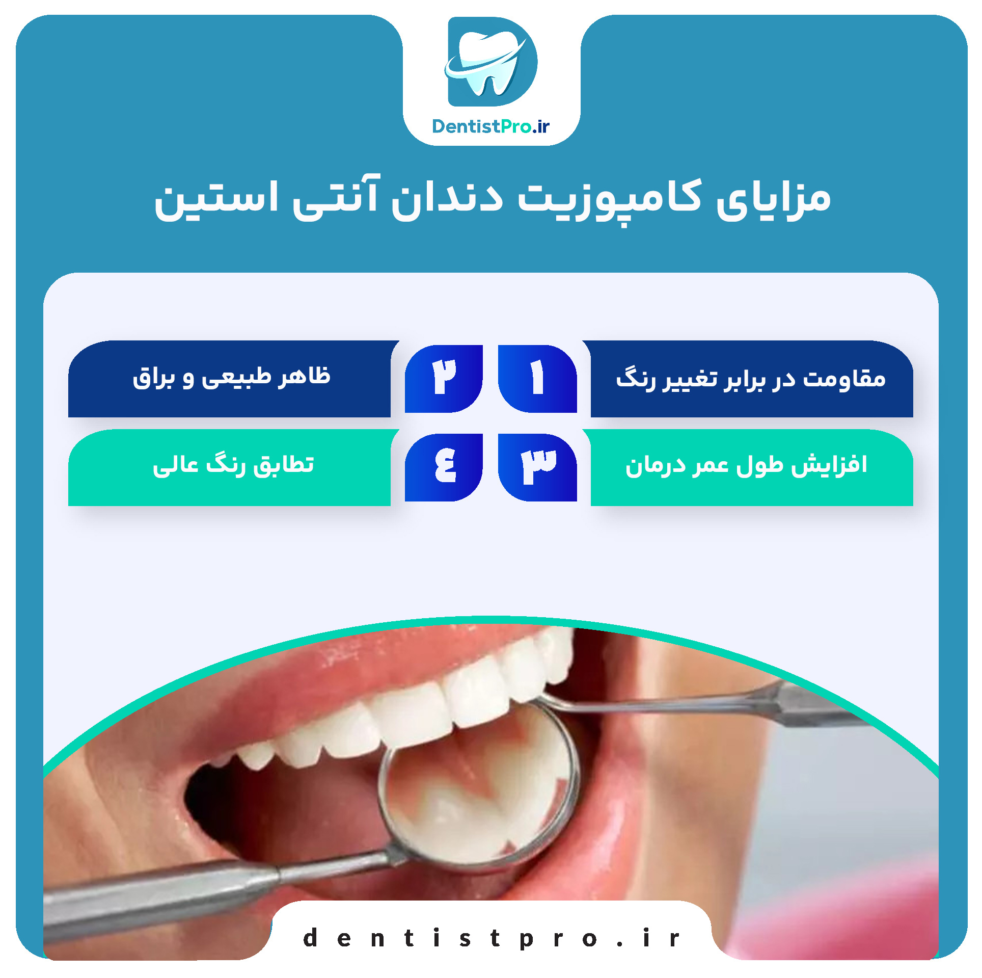 کامپوزیت دندان آنتی استین+راهکاری برای لبخندی ماندگار و بدون تغییر رنگ