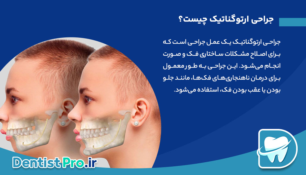 جراحی ارتوگناتیک: اصلاح مشکلات فکی و بهبود عملکرد و زیبایی 26 جراحی ارتوگناتیک: اصلاح مشکلات فکی و بهبود عملکرد و زیبایی