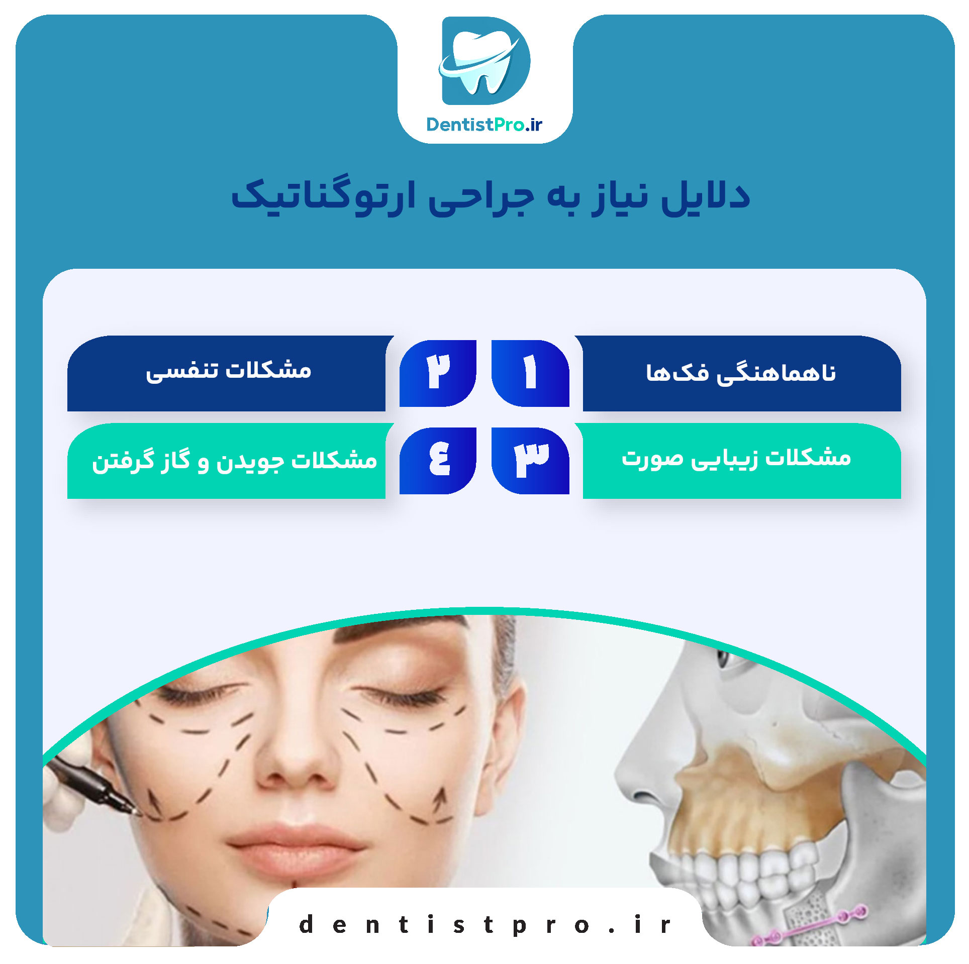 جراحی ارتوگناتیک: اصلاح مشکلات فکی و بهبود عملکرد و زیبایی 27 جراحی ارتوگناتیک: اصلاح مشکلات فکی و بهبود عملکرد و زیبایی