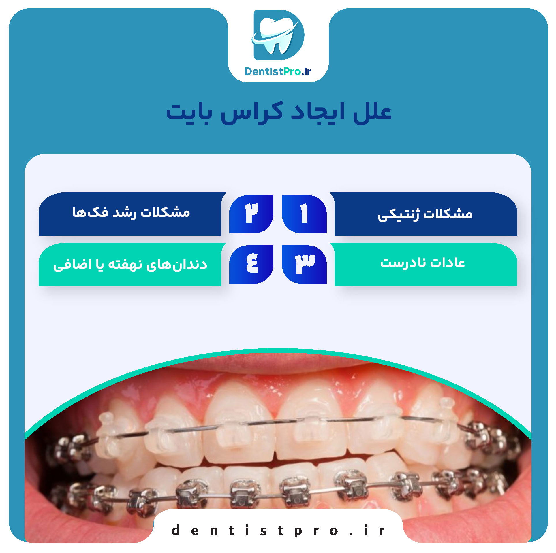 درمان کراس بایت با ارتودنسی