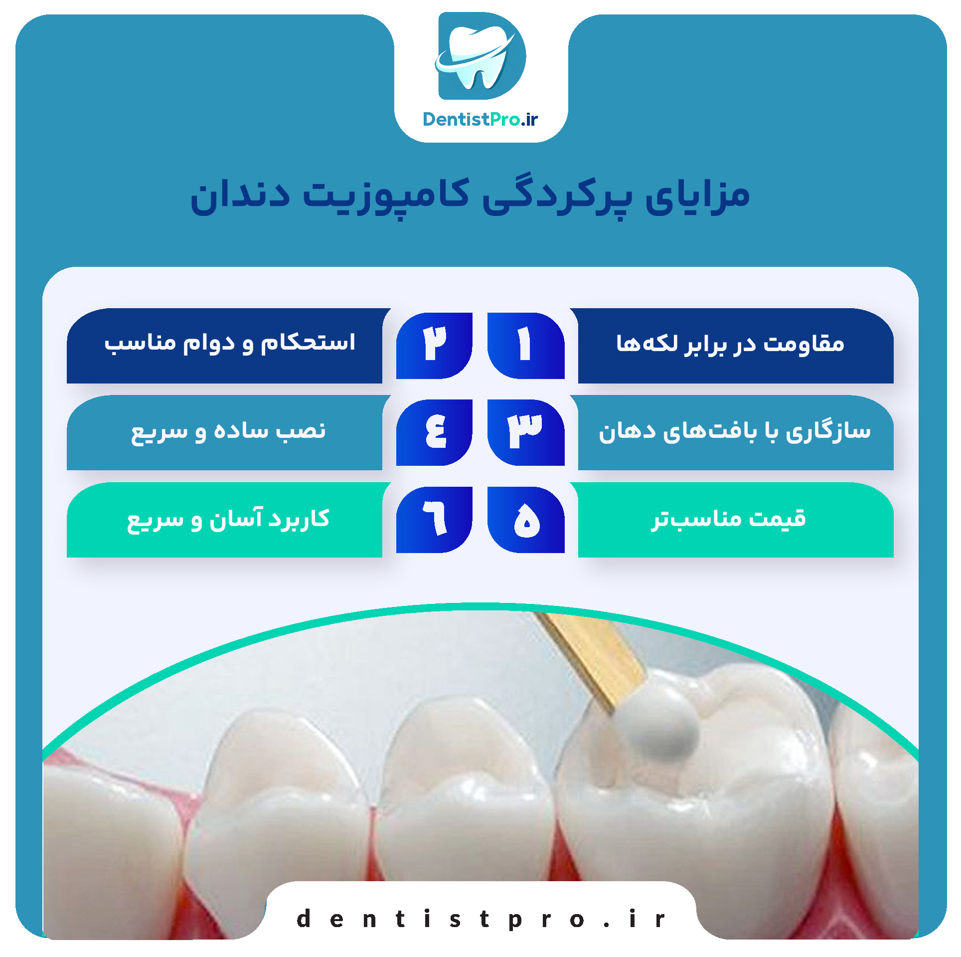 مزایای پرکردگی کامپوزیت دندان: چرا این انتخاب بهترین است؟