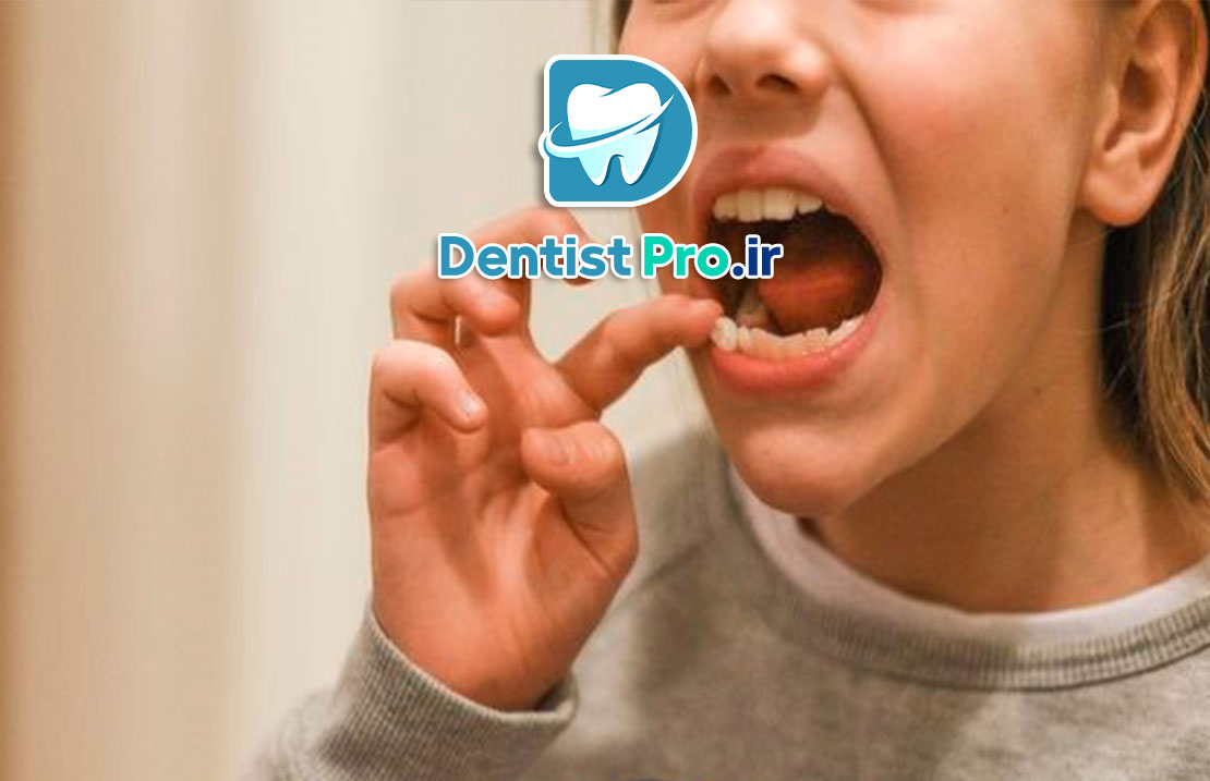 علت لق شدن دندان دائمی در بزرگسالان+0 تا 100 مطالب مهم