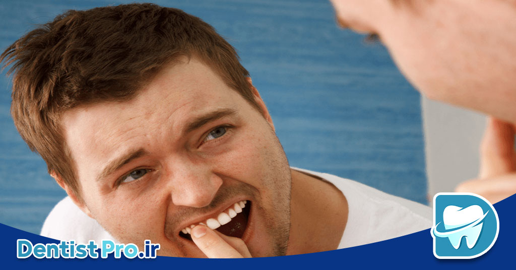 علت لق شدن دندان دائمی در بزرگسالان+0 تا 100 مطالب مهم