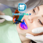 پر کردن دندان بدون صدای دریل: انقلابی در دندانپزشکی مدرن