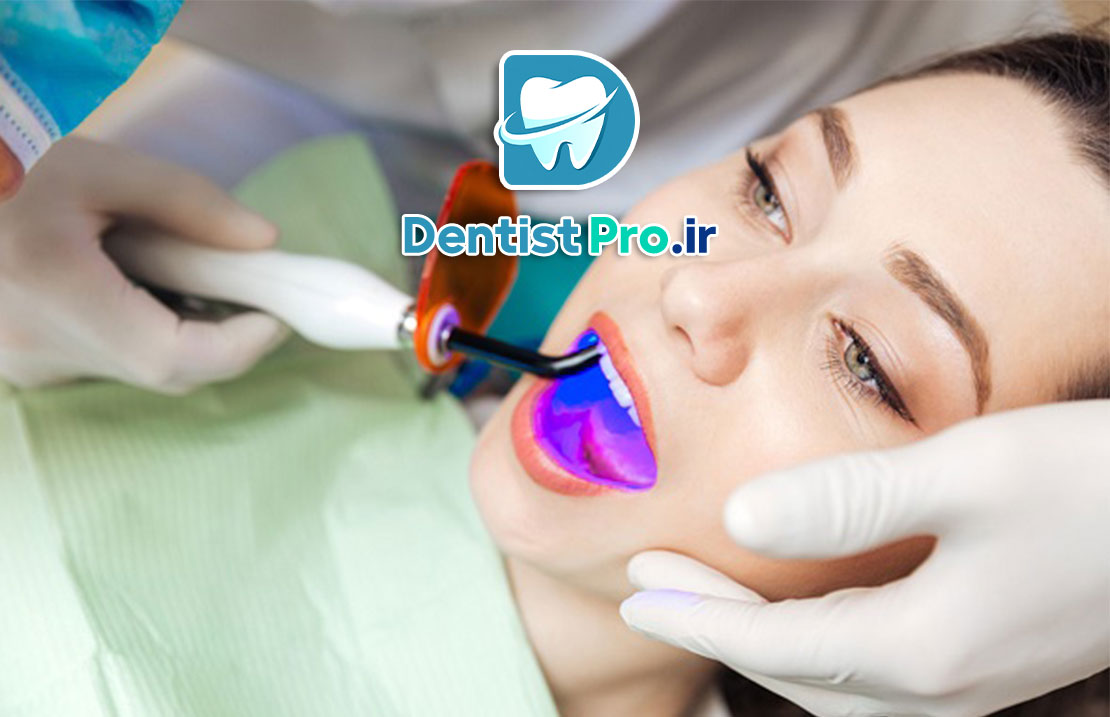 پر کردن دندان بدون صدای دریل: انقلابی در دندانپزشکی مدرن 25 پر کردن دندان بدون صدای دریل: انقلابی در دندانپزشکی مدرن
