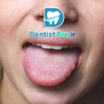 بیماری های زبان: شناخت، علل، علائم و روش‌های درمان