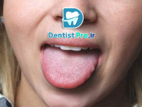 بیماری های زبان: شناخت، علل، علائم و روش‌های درمان