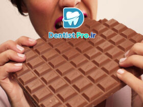 اثرات شکلات بر دندان ها+ 5 مطلب اساسی