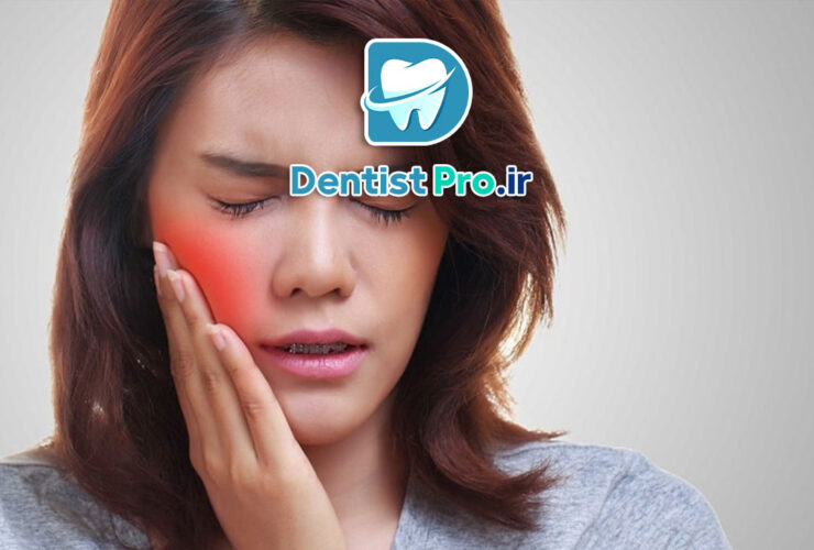 ورم صورت بعد از ایمپلنت دندان؛ علل، روش‌های کنترل و مراقبت‌های لازم