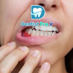 لثه در دوران بارداری: مراقبت‌ها، مشکلات و راهکارهای حفظ سلامت