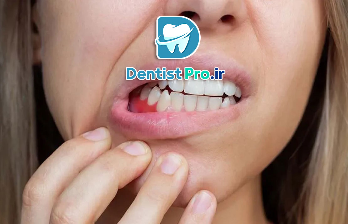 لثه در دوران بارداری: مراقبتها، مشکلات و راهکارهای حفظ سلامت 25 لثه در دوران بارداری: مراقبتها، مشکلات و راهکارهای حفظ سلامت