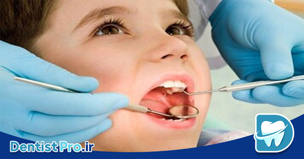 تغذیه سالم برای دندان کودک؛ کلید سلامت دهان و دندان کودکان