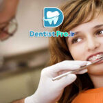 درد ارتودنسی در هفته اول+ موارد بسیار مهم