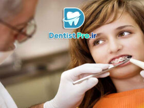 درد ارتودنسی در هفته اول+ موارد بسیار مهم