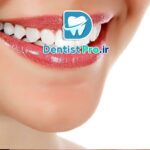 سفید کردن دندان در خانه یا مطب