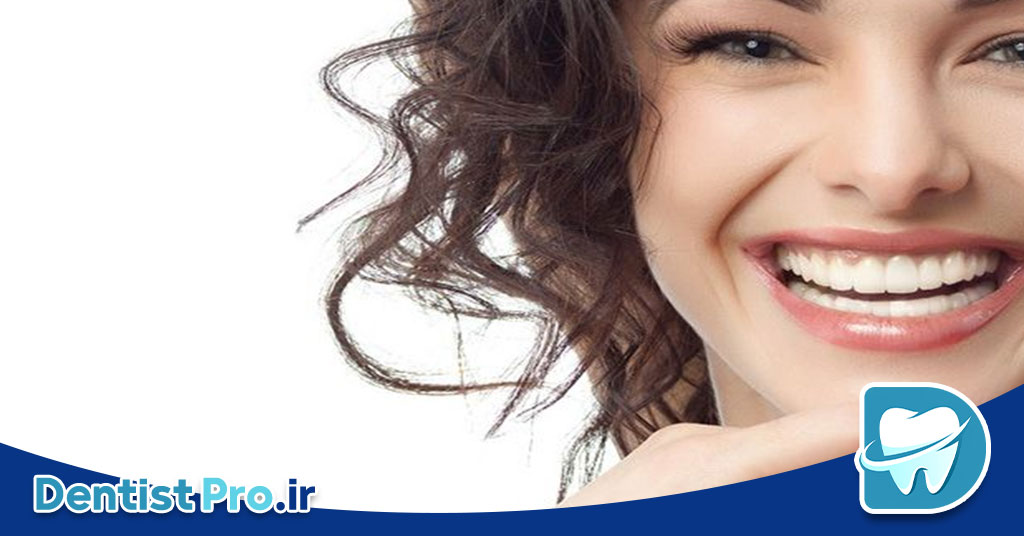 فیسینگ دندان برای لبخند بازیگران؛ راز زیبایی بینقص و اعتماد به نفس 29 فیسینگ دندان برای لبخند بازیگران؛ راز زیبایی بینقص و اعتماد به نفس
